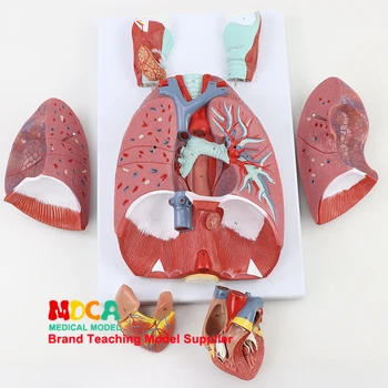 Dihalni Sistem, Model, Dihalnih Poti, Grla, Pljuč, Srca, Človeški Organ, Anatomija Medicinski Model Poučevanja MHXXT003