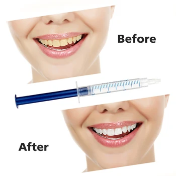 Zobni Peroksid Za Beljenje Zob Komplet Za Beljenje Zob Gel Kompleti Za Zobozdravstveno Belilna Zobna Oprema Za Ustno Higieno Nasmeh Izdelki