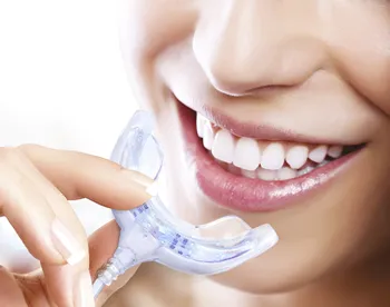 Zobni zob Paket. Komplet vključuje LED luči ustni naprave in beljenje zob gel. BELJENJE SVETLOBE