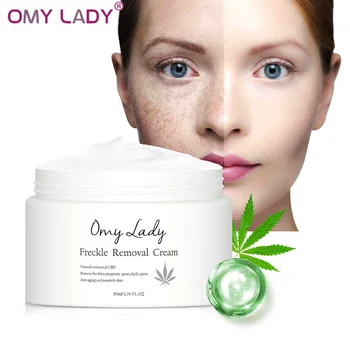 OMY LADY Freckle Removal Cream Odstranite Freckle Noseča Vložki Melanin Temen madež Anti Aging Zob Facial Cream Osvetlitev