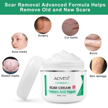 50 ML Effectivel Scar Removal Cream Napredno Zdravljenje Obraza in Telesa, Brazgotine Kosi Strij C-Oddelkih, Ambulantah za Nego Kože
